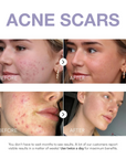Klyne RX™ - Dark Spot Corrector