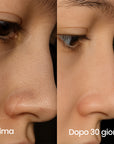 IonClear™ Skin Detox Nasale - Seon