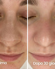 IonClear™ Skin Detox Nasale - Seon