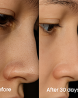 IonClear™ Blackheads Nose Patches - Seon