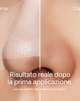 IonClear™ Skin Detox Nasale - Seon