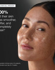 Klyne RX™ - Dark Spot Corrector