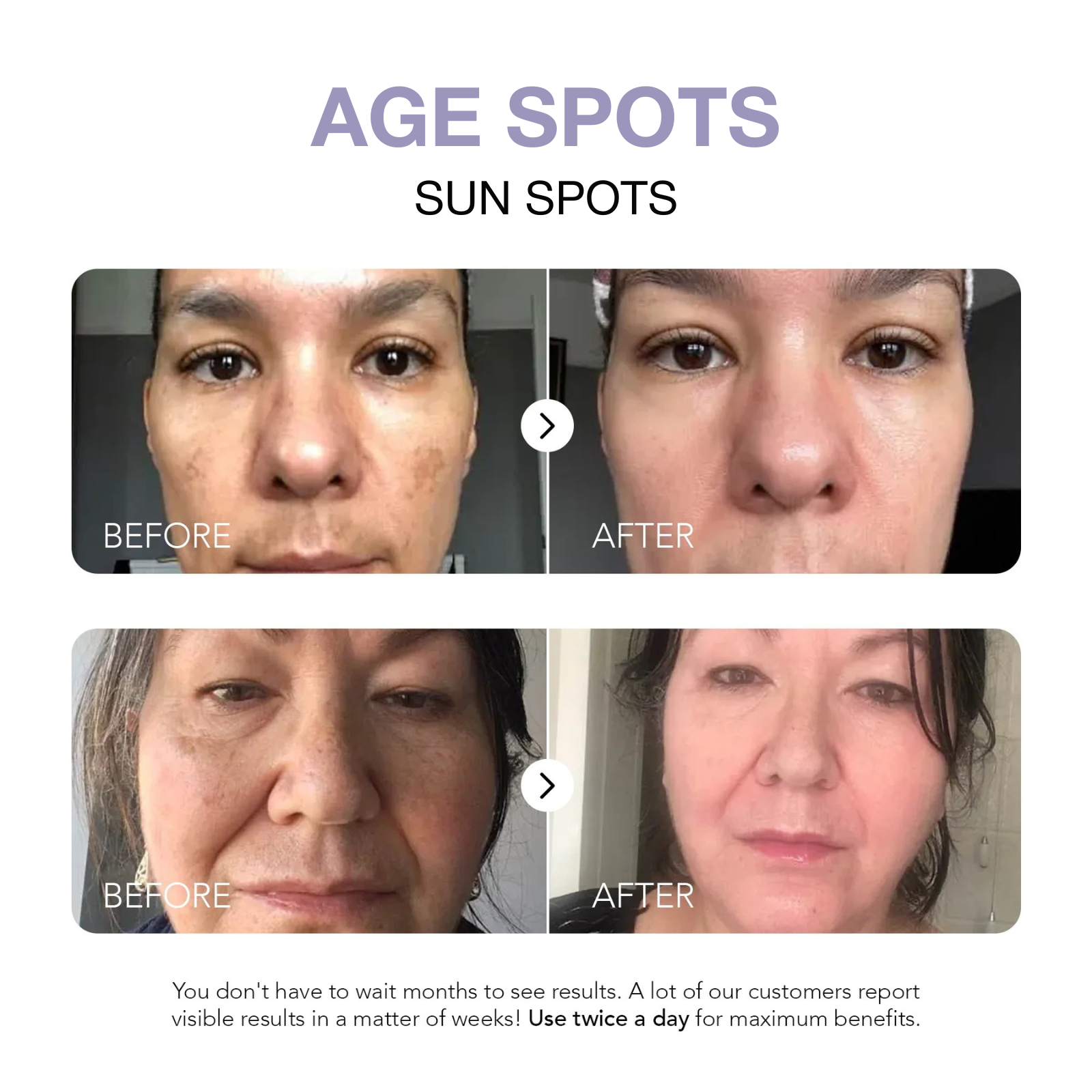 Klyne RX™ - Dark Spot Corrector