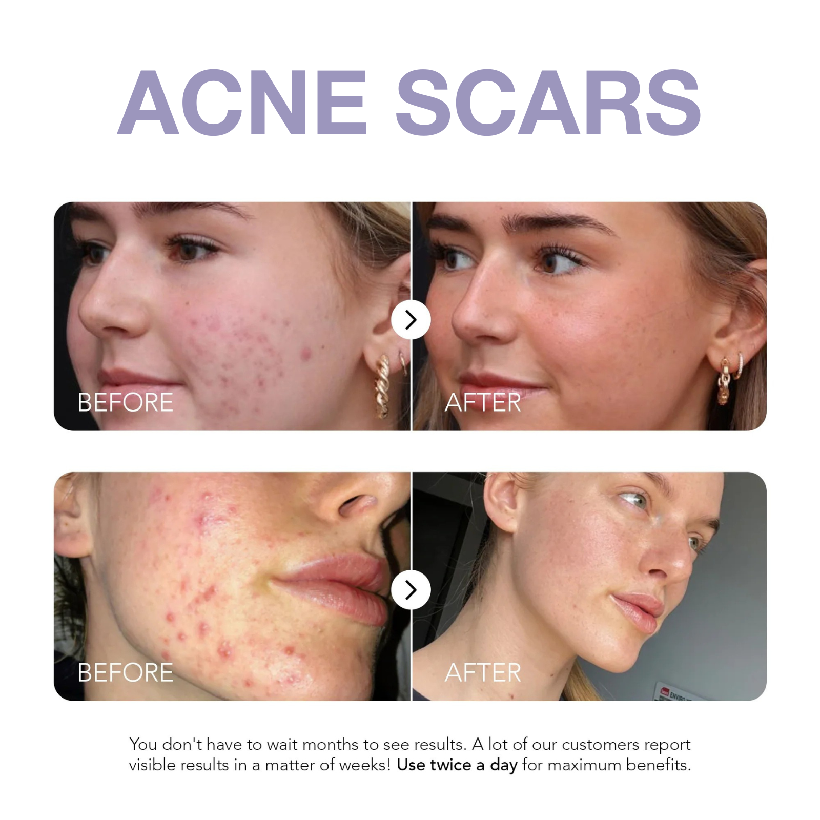 Klyne RX™ - Dark Spot Corrector