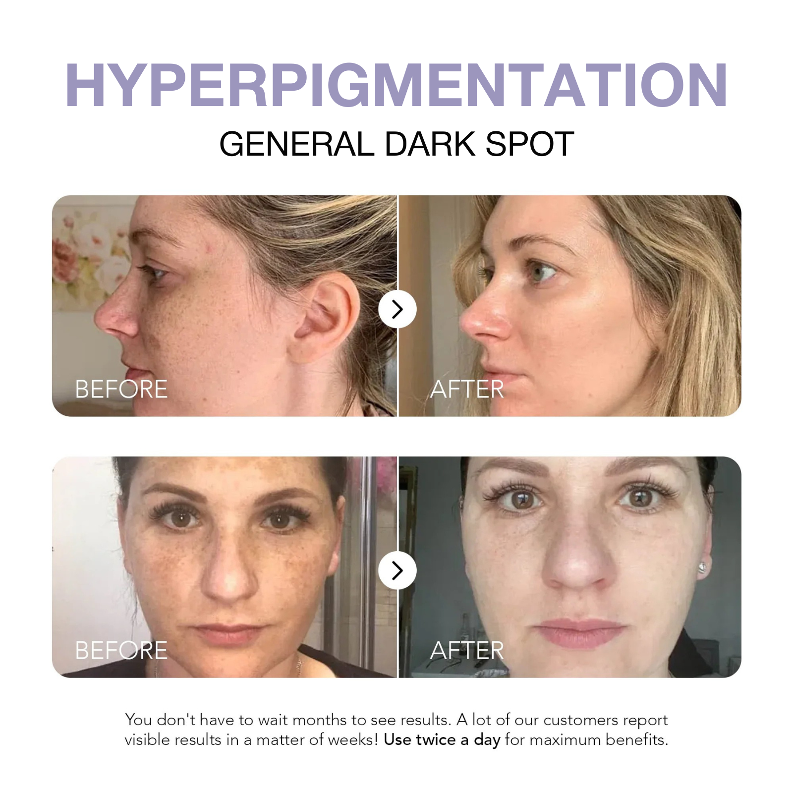Klyne RX™ - Dark Spot Corrector